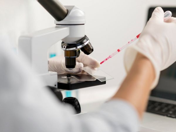 Darkfield analiza žive kapi krvi – pogled u unutarnji svijet vašeg zdravlja Darkfield analiza žive kapi krvi – pogled u unutarnji svijet vašeg zdravlja